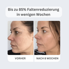 Sérum de botulisme naturel